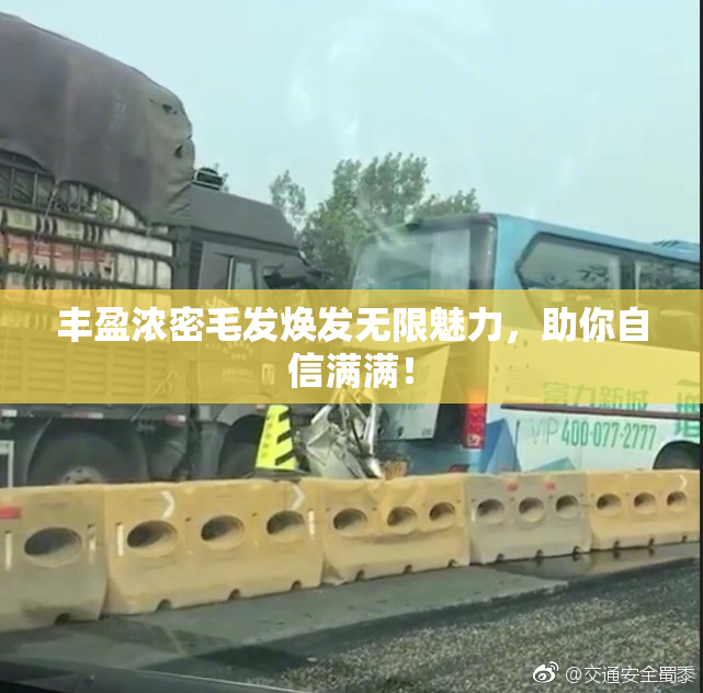丰盈浓密毛发焕发无限魅力，助你自信满满！