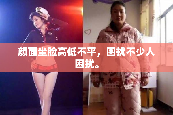 颜面坐脸高低不平，困扰不少人困扰。