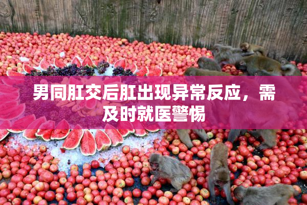 男同肛交后肛出现异常反应，需及时就医警惕