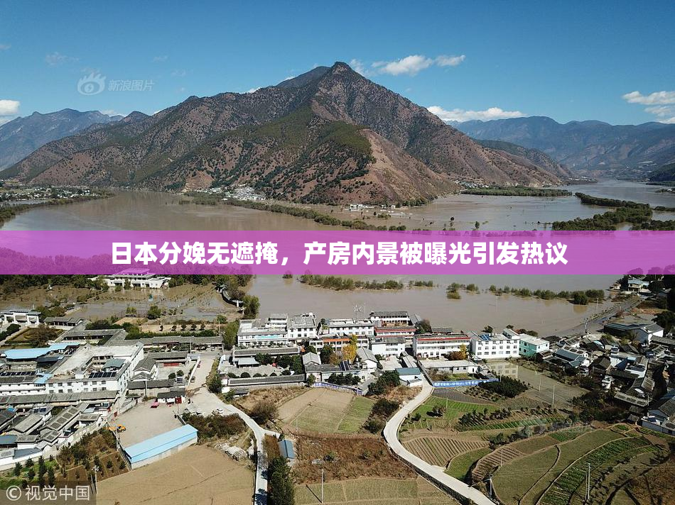 日本分娩无遮掩，产房内景被曝光引发热议