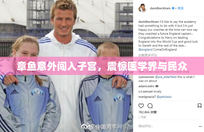 章鱼意外闯入子宫，震惊医学界与民众