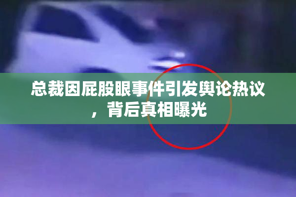 总裁因屁股眼事件引发舆论热议，背后真相曝光