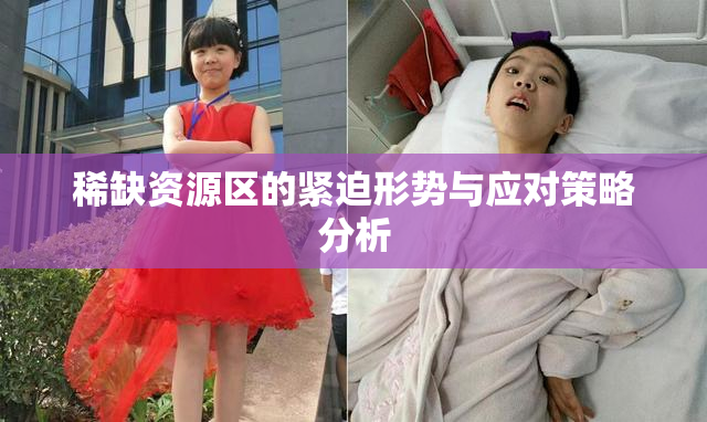 稀缺资源区的紧迫形势与应对策略分析