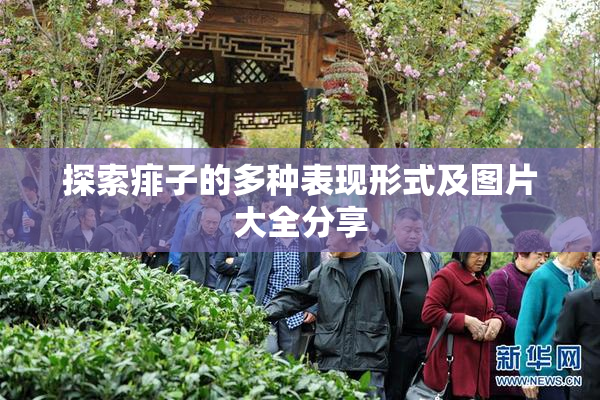 探索痱子的多种表现形式及图片大全分享