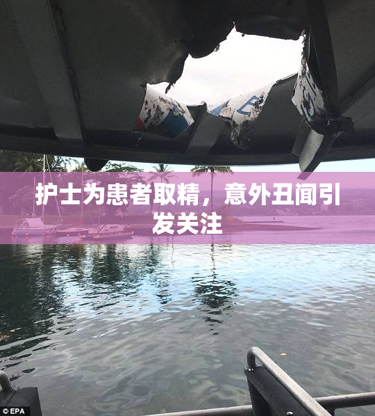 护士为患者取精，意外丑闻引发关注