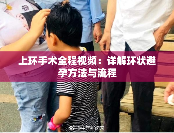 上环手术全程视频：详解环状避孕方法与流程