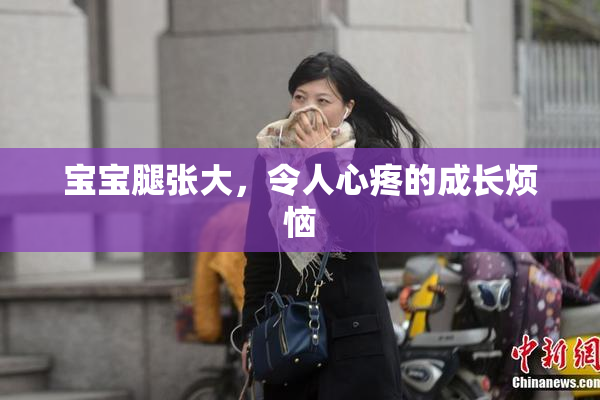 宝宝腿张大，令人心疼的成长烦恼