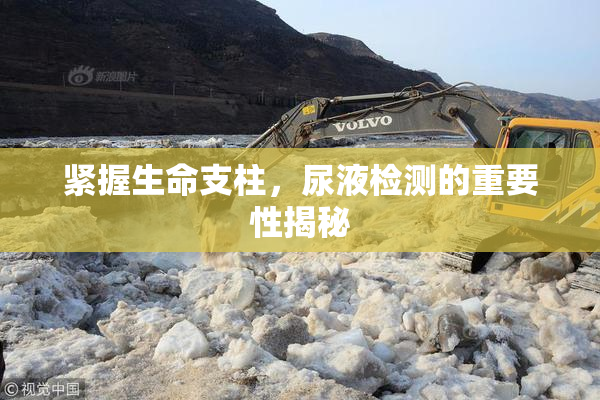 紧握生命支柱，尿液检测的重要性揭秘