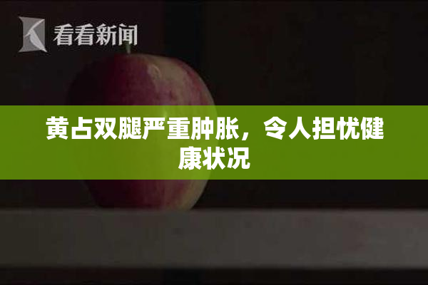 黄占双腿严重肿胀，令人担忧健康状况