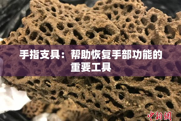手指支具：帮助恢复手部功能的重要工具